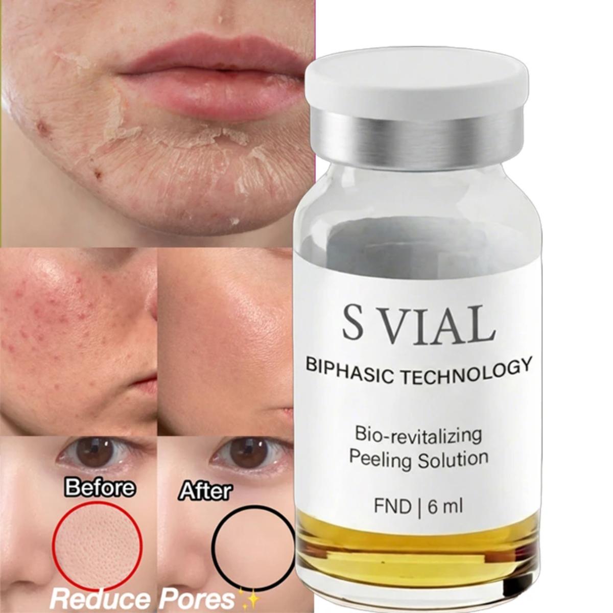 S VIAL Bio-revitalizante solución peeling